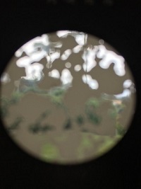 Shows simulation of patch vision loss